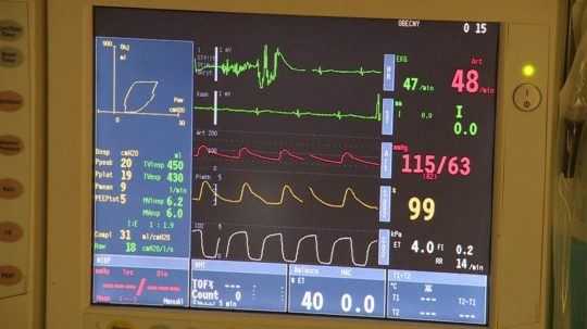 monitoring životných funkcií