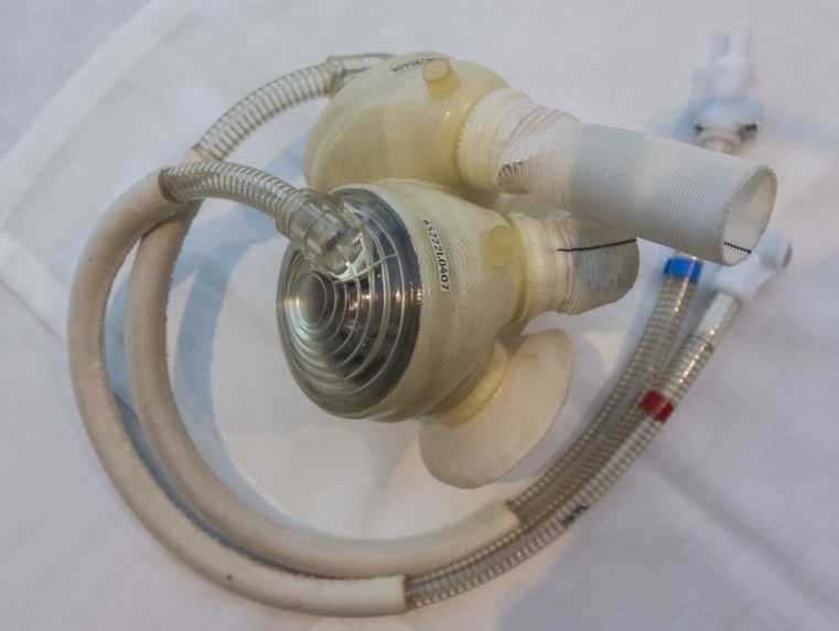 Typ umelého srdca, ktoré implantovali pacientovi v Bratislave.