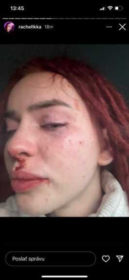 Bitka aj zničený byt. Na prípad napadnutej influencerky reaguje aj generálny prokurátor