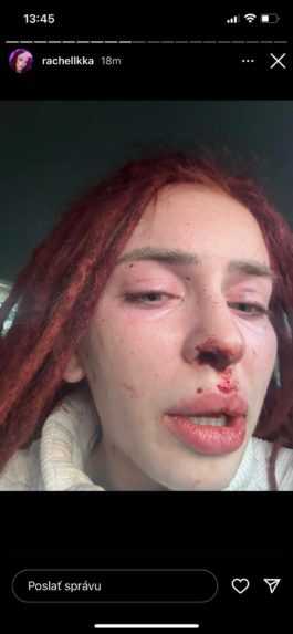 Bitka aj zničený byt. Na prípad napadnutej influencerky reaguje aj generálny prokurátor