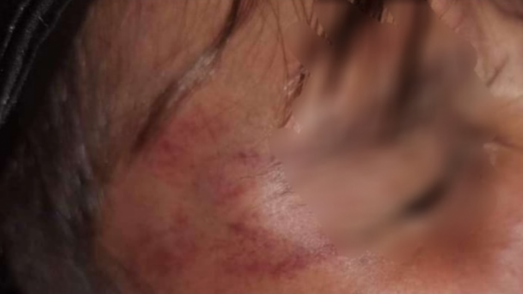 Tentoraz si tínedžerskí bitkári vybrali za obeť 12-ročného chlapca.
