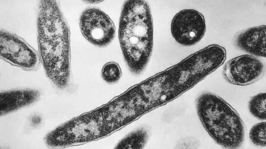 Baktérie Legionella pneumophila, ktoré spôsobujú pľúcne ochorenie legionársku chorobu.