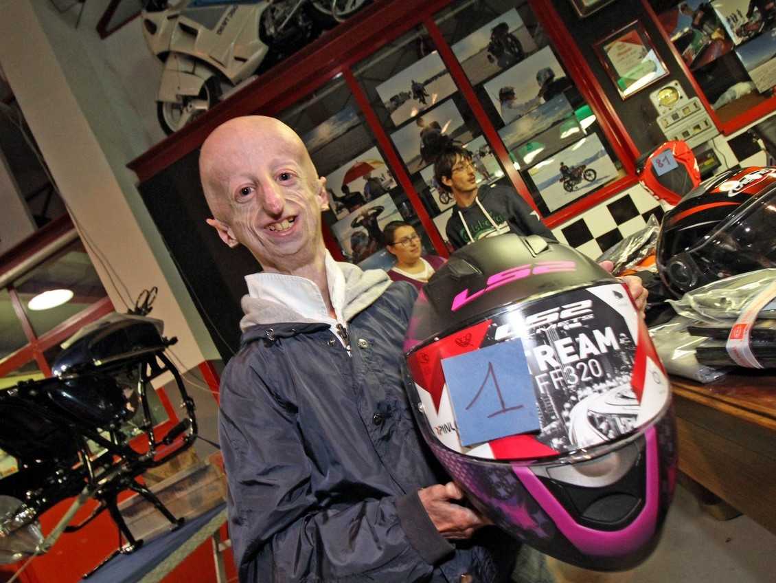 Zomrel Sammy Basso, najdlhšie žijúci človek s progeriou