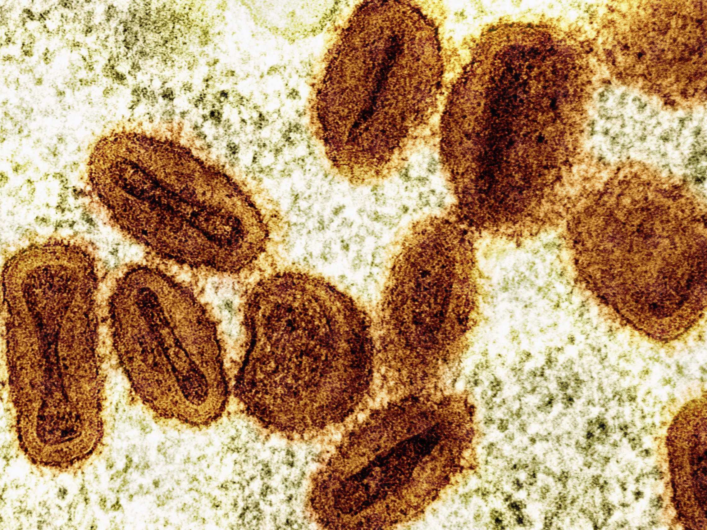 Opičie kiahne (mpox) sú infekčné ochorenie, ktoré sa prenáša pri blízkom kontakte.