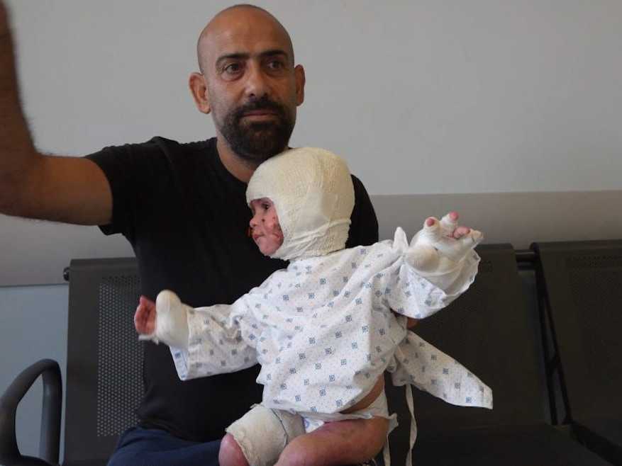 Otec s malou dcérkou na kolenách, ktorá má obviazanú hlavu a ruky.