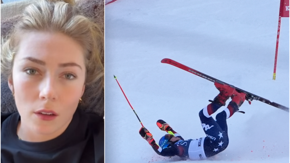 Shiffrinová má päť dní po páde stále bolesti. Po návrate domov zamierila ihneď do nemocnice