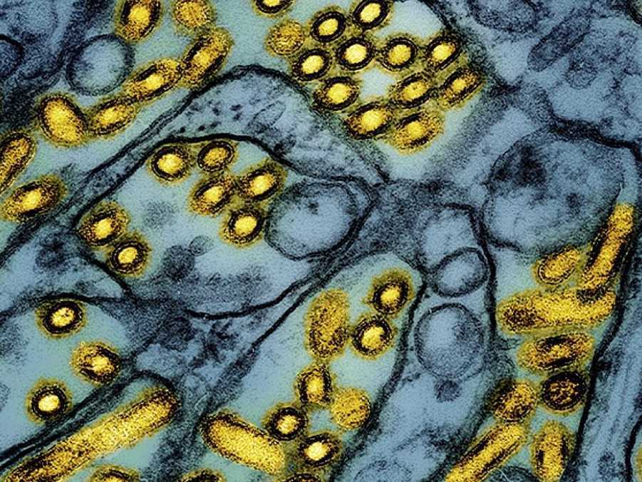 Častice vírusu vtáčej chrípky H5N1 (žltá farba).T