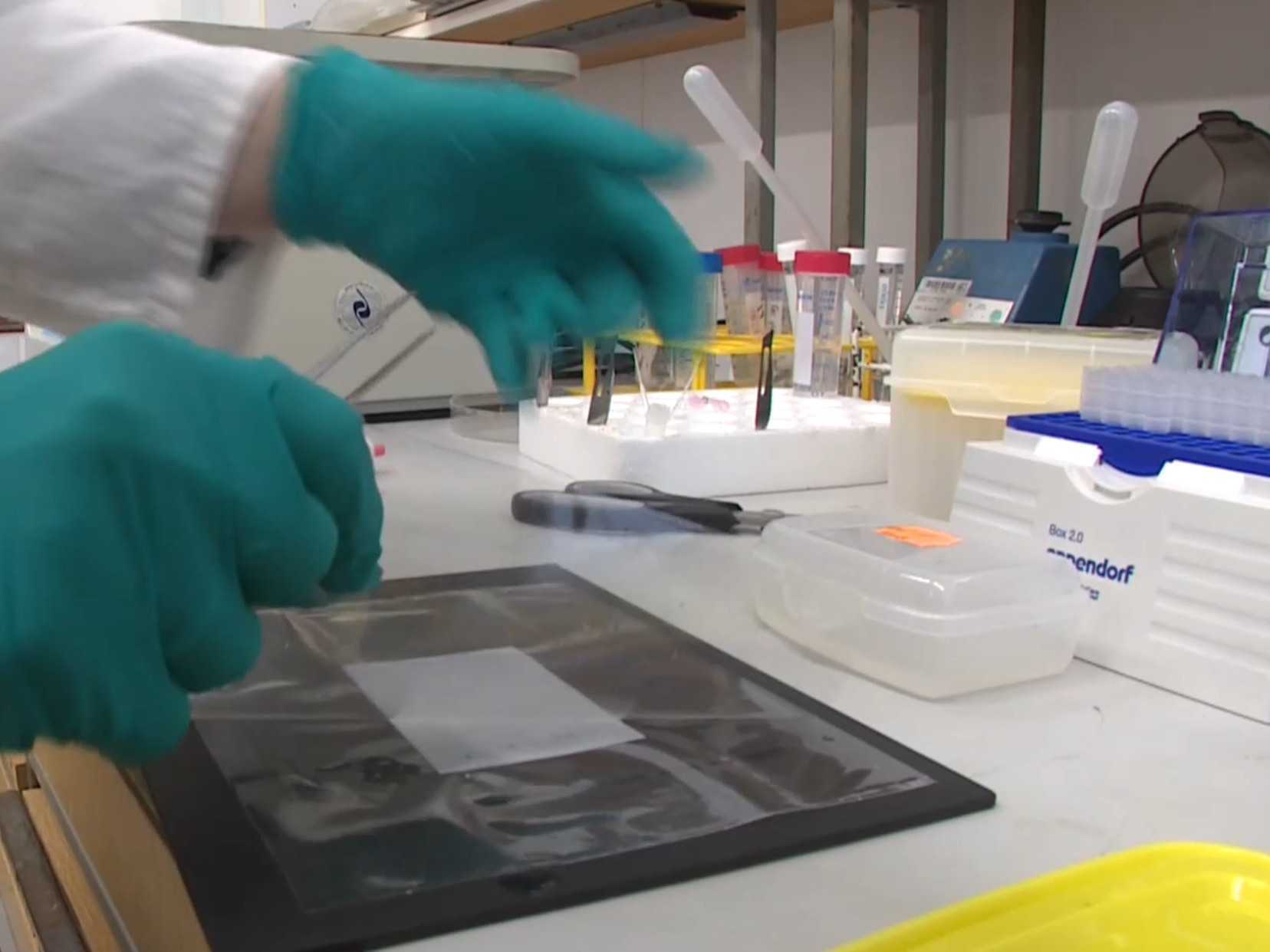 Molekulu objavili vedci zo SAV v spolupráci s lekármi.