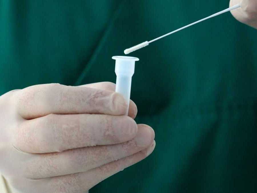 Osoba na snímke pracuje s testovacím antigénovým testom na COVID-19.