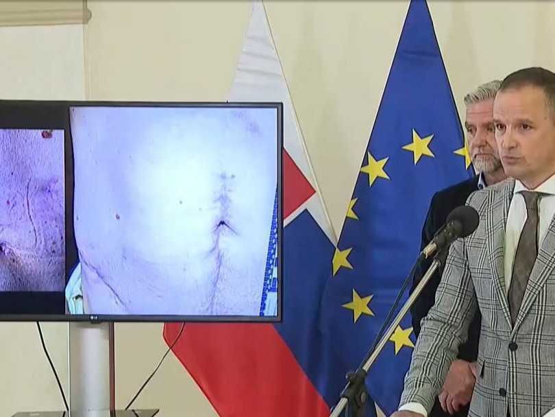 D. Lindtner a T. Gašpar pri odhalení fotografií zranení R. Fica po streľbe v Handlovej.