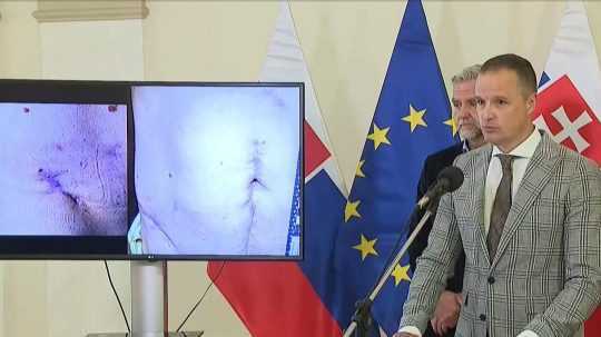 D. Lindtner a T. Gašpar pri odhalení fotografií zranení R. Fica po streľbe v Handlovej.