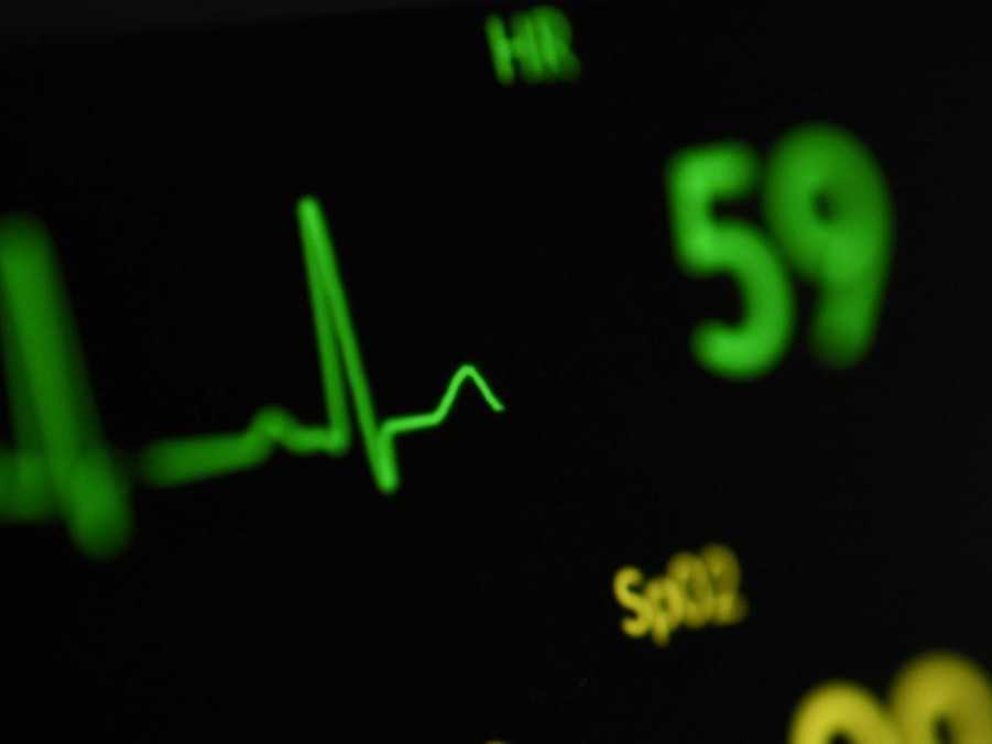 Ilustračná snímka nemocničného prístroja.