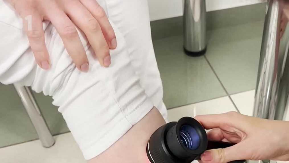 Výskyt melanómu kože môže v najbližších desaťročiach narásť až o 40 percent. Ohrozené sú najmä malé deti