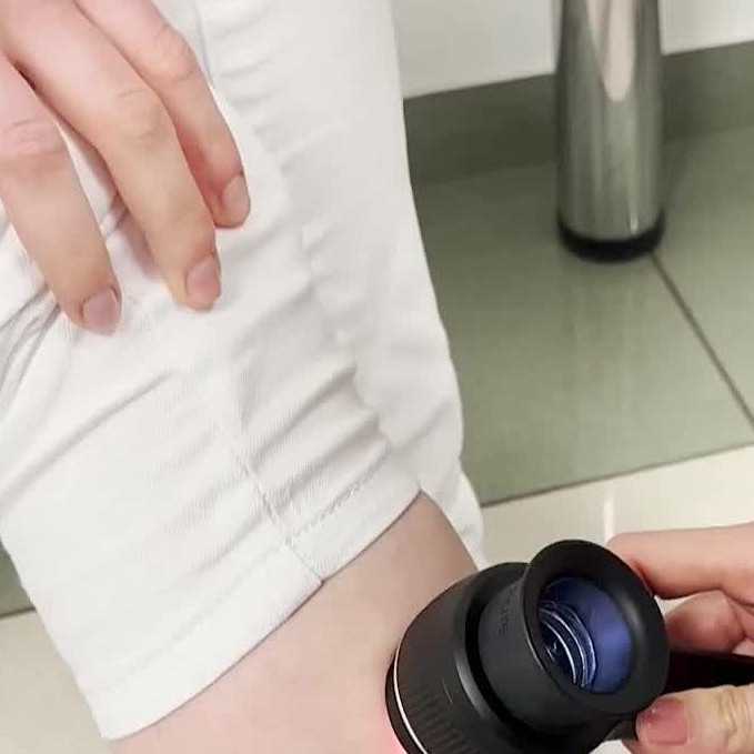 Výskyt melanómu kože môže v najbližších desaťročiach narásť až o 40 percent. Ohrozené sú najmä malé deti