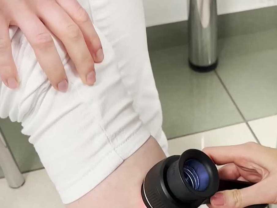 Výskyt melanómu kože môže v najbližších desaťročiach narásť až o 40 percent. Ohrozené sú najmä malé deti