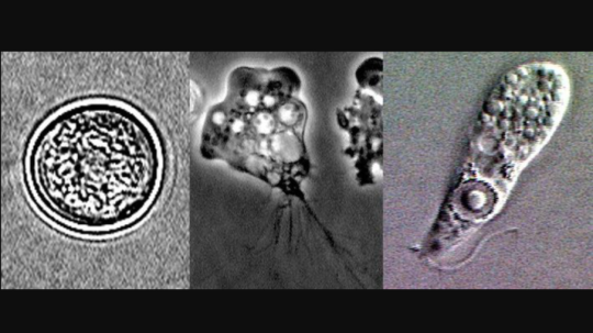 Laboratórna snímka jednobunkového organizmu Naegleria fowleri.