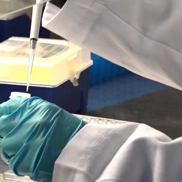 Zastavenie pomoci USAID sa začína prejavovať: V Afrike klesá počet testovaní na HIV, tisícom ľudí hrozí smrť
