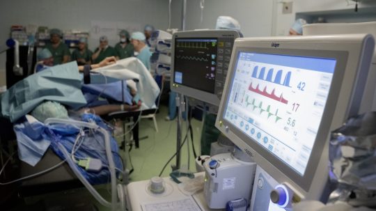 monitory na operačnej sále