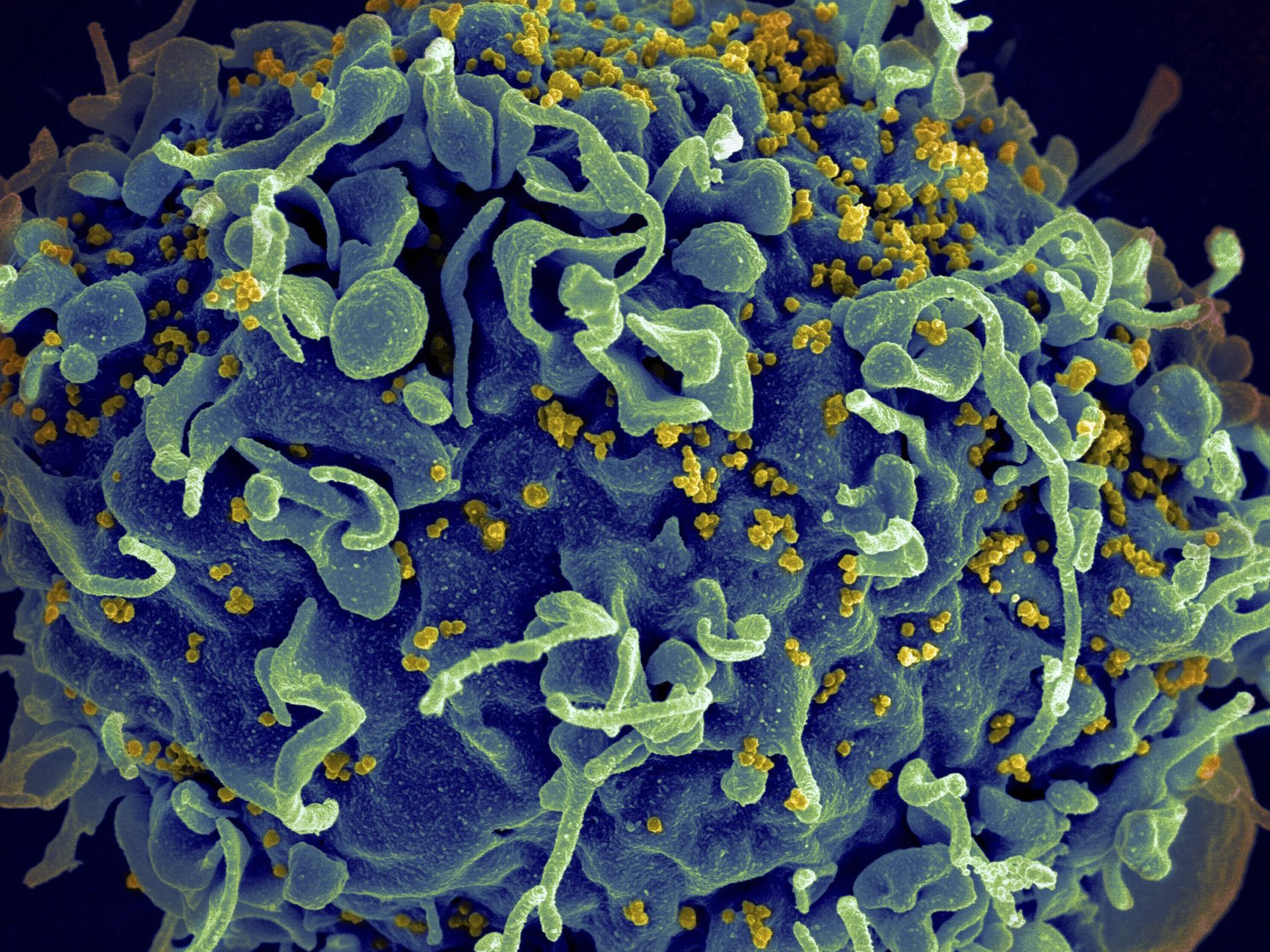 mikroskopický snímok