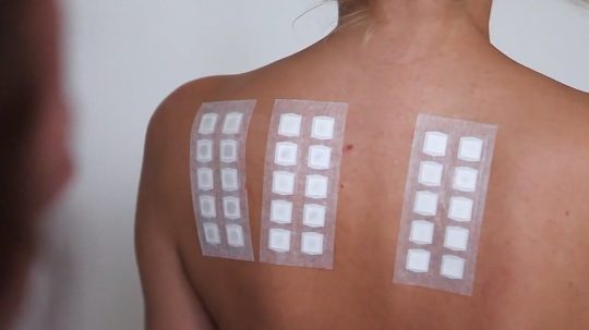 Alergický test.