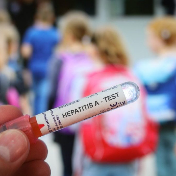 Na ilustračnej snímke test na hepatitídu.