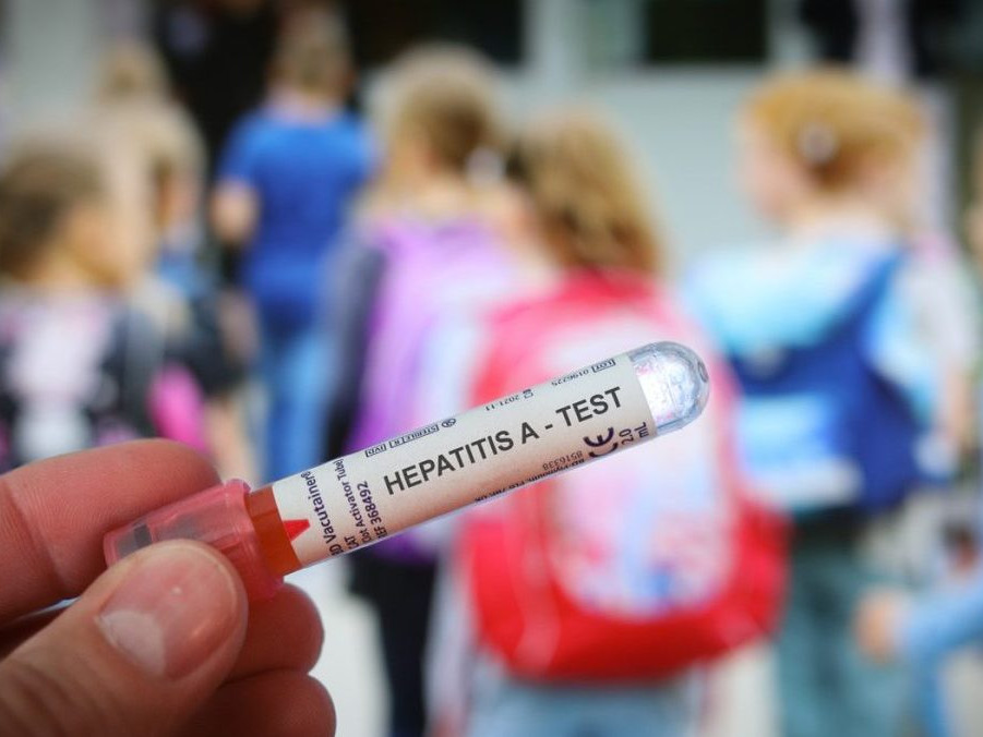 Na ilustračnej snímke test na hepatitídu.