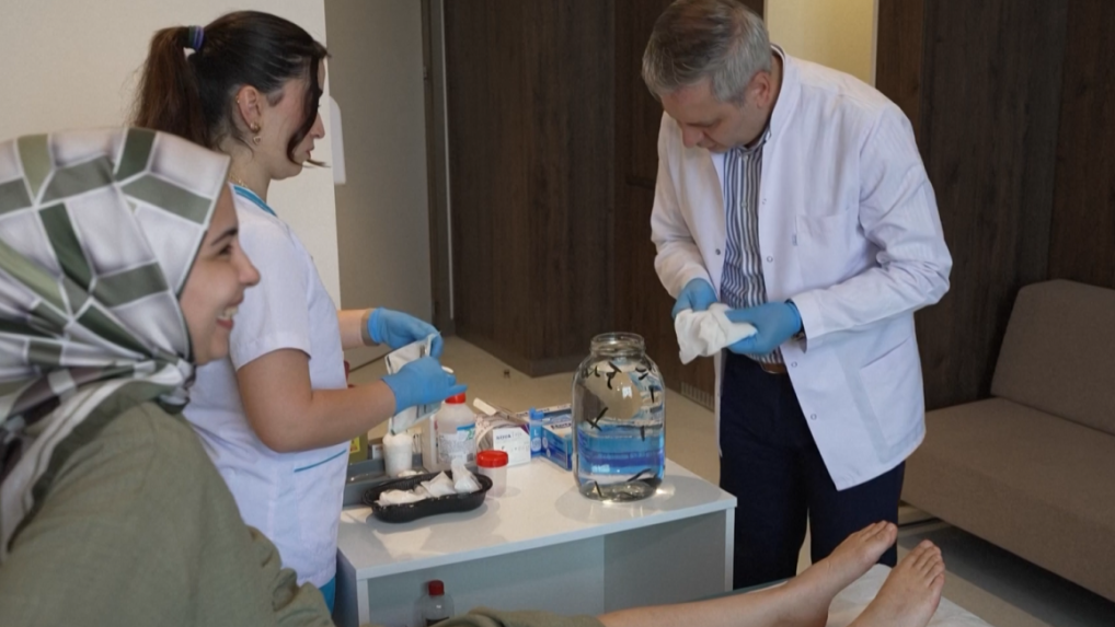 Pijavice, bankovanie aj akupunktúra: Do tureckých nemocníc sa vracia stará medicína, lekári ju kombinujú s modernou