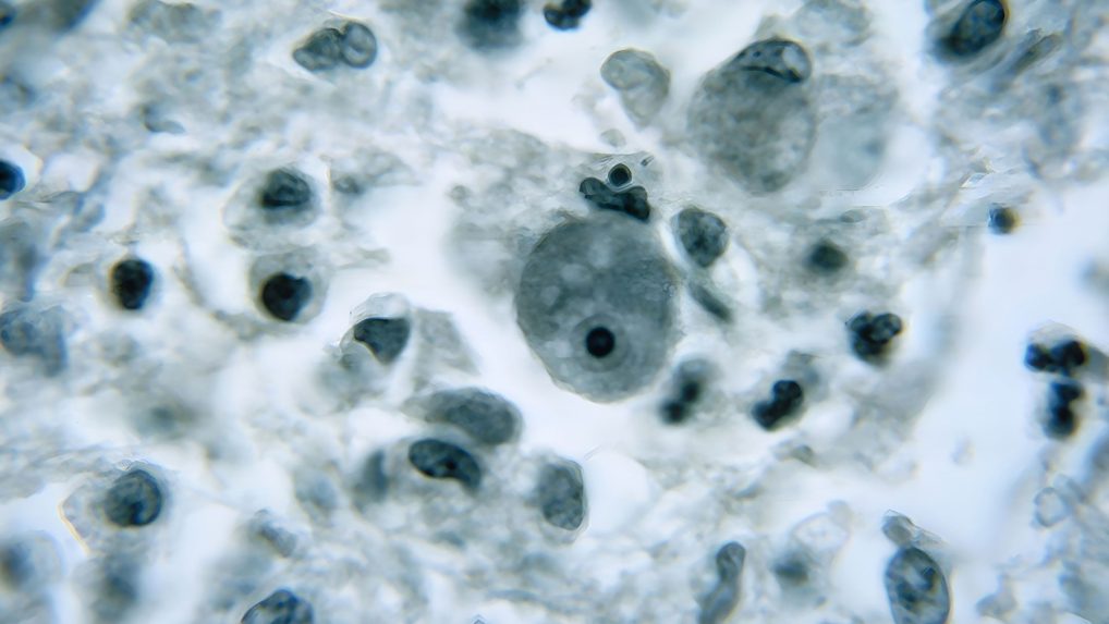 Améba Naegleria fowleri.
