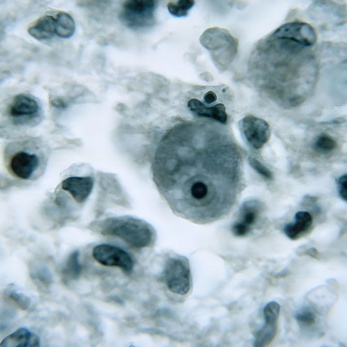 Améba Naegleria fowleri.