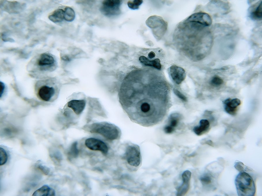 Améba Naegleria fowleri.