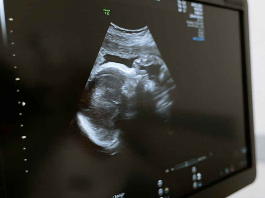 Na ilustračnej snímke ultrazvuk.