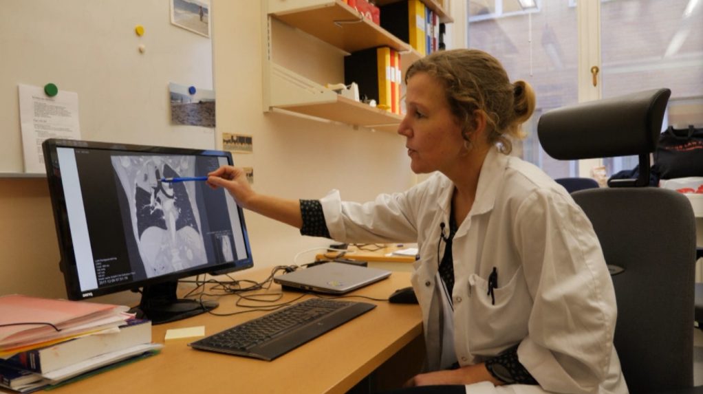 lekárka ukazuje na RTG snímok