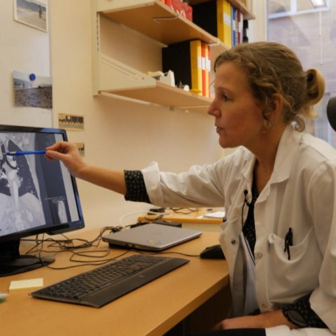 lekárka ukazuje na RTG snímok