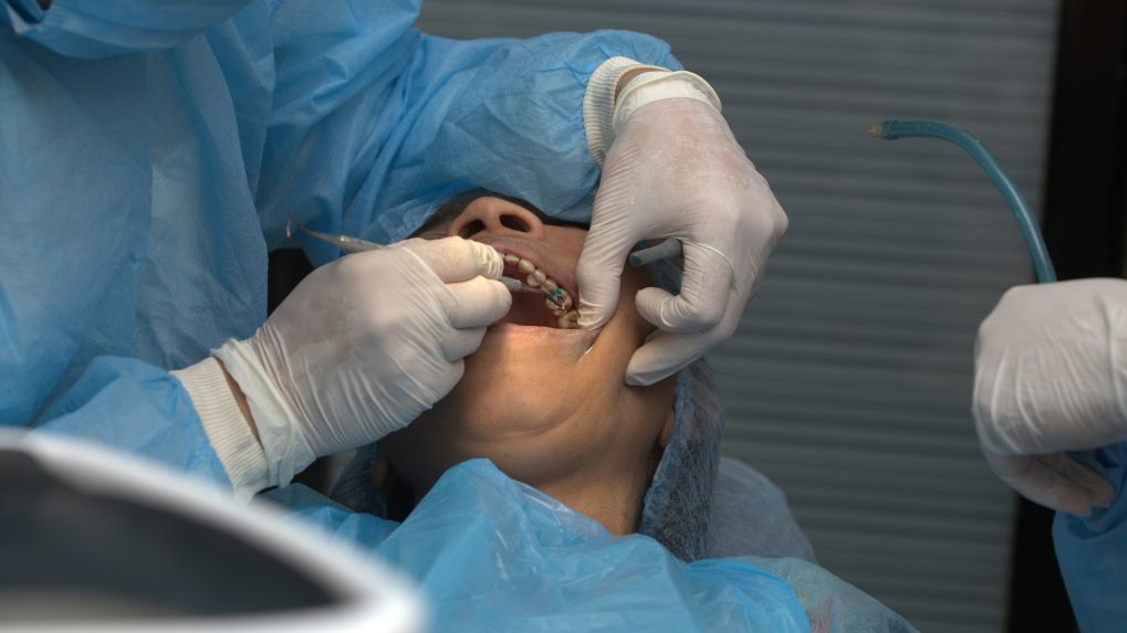 Osoba na zubnom vyšetrení.