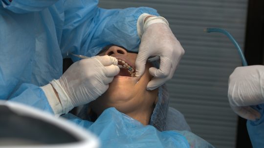 Osoba na zubnom vyšetrení.