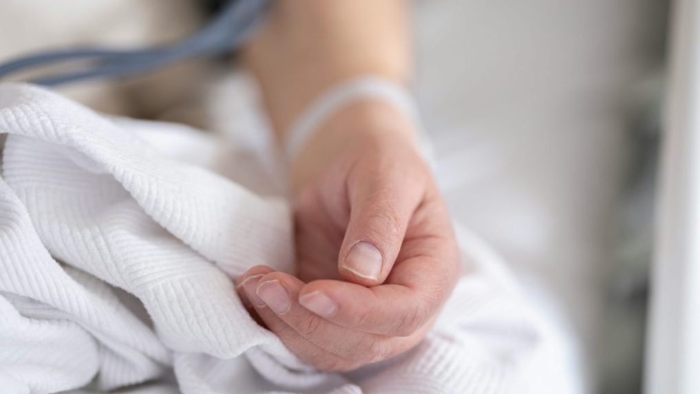 Ilustračná snímka pacienta.