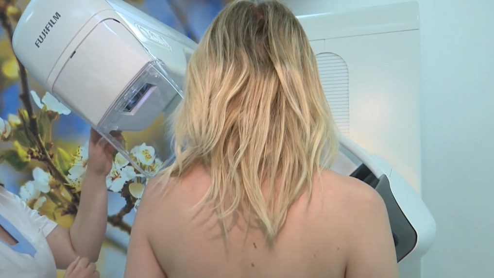 žena na vyšetrení prsníka