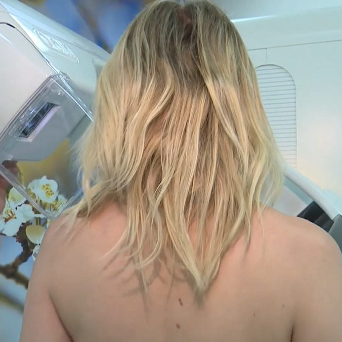 žena na vyšetrení prsníka