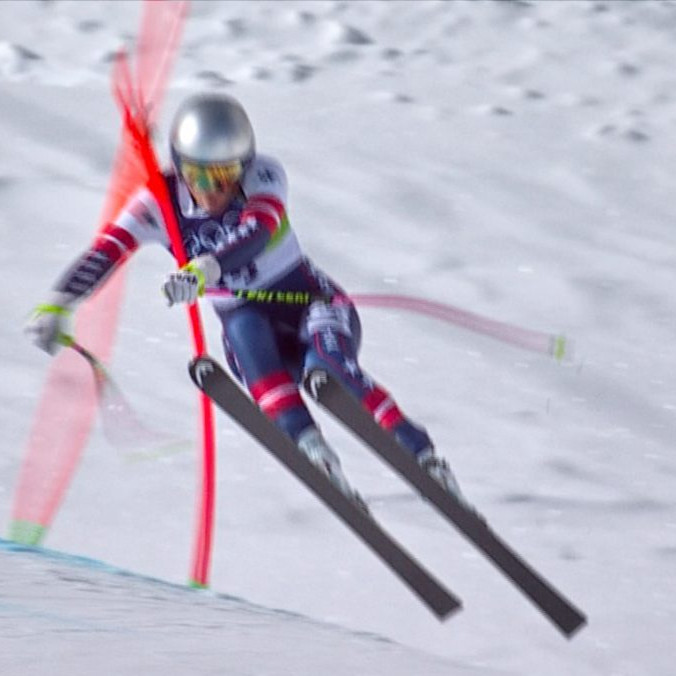 Lindsey Vonnová mala po páde v olympijskom zjazde podstúpiť aj druhú operáciu zlomenej nohy