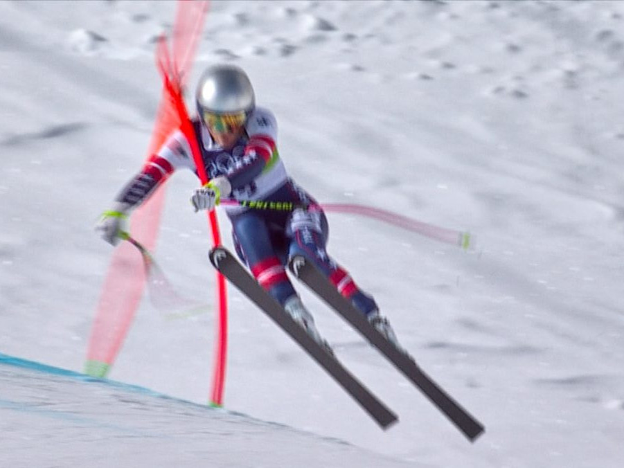 Lindsey Vonnová mala po páde v olympijskom zjazde podstúpiť aj druhú operáciu zlomenej nohy