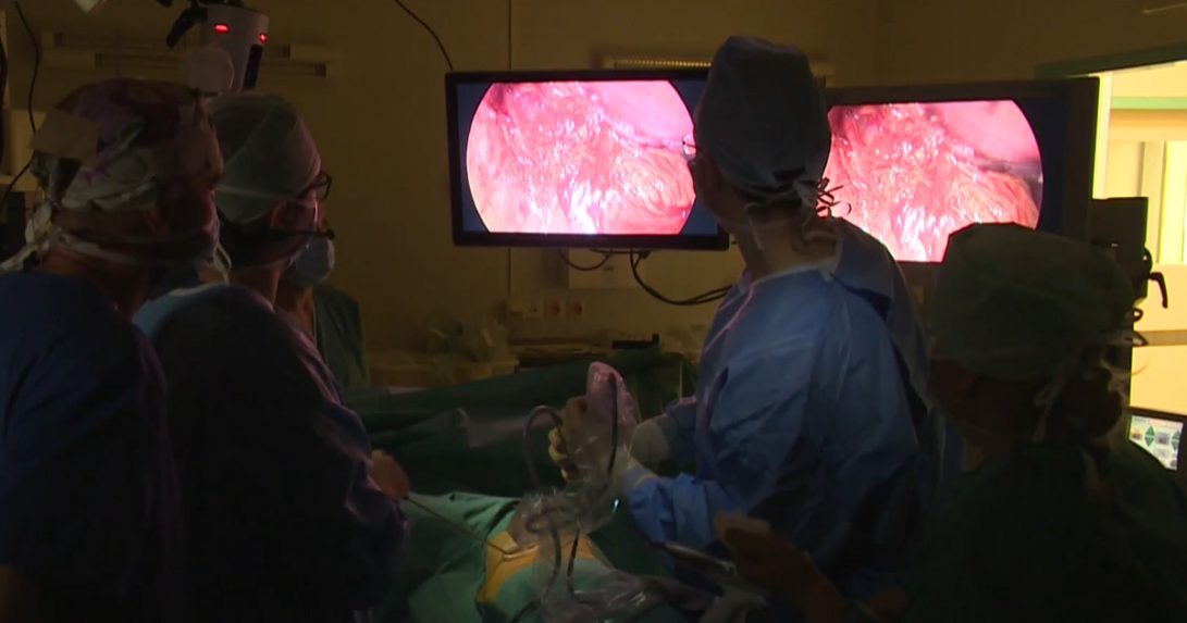 lekári počas operácie