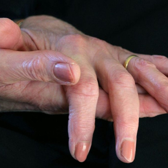 Na ilustračnej snímke ruky staršej ženy.