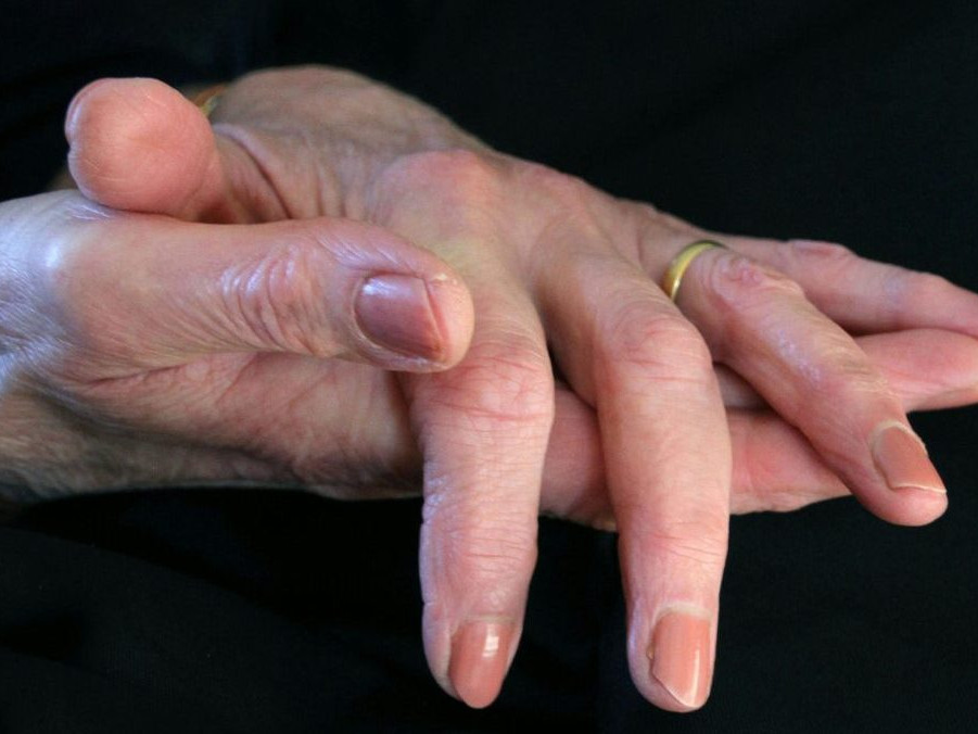 Na ilustračnej snímke ruky staršej ženy.