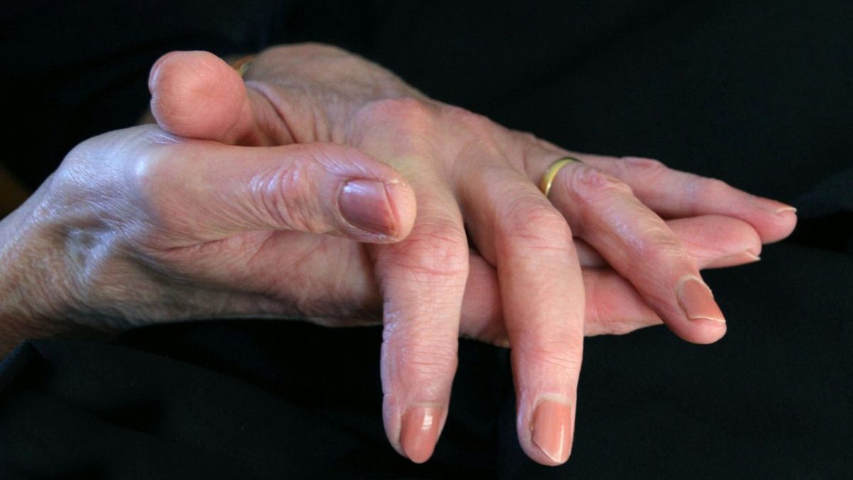 Menopauza je pre pokožku zlomov&aacute;, žena m&ocirc;že stratiť tretinu kolag&eacute;nu. Ako sa v tomto obdob&iacute; postarať o pleť?