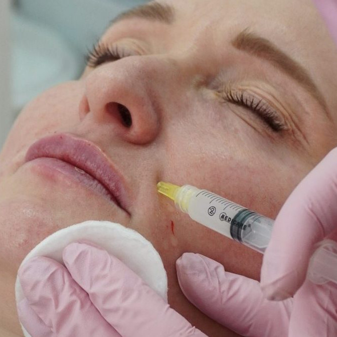 Kozmetický salón, botox