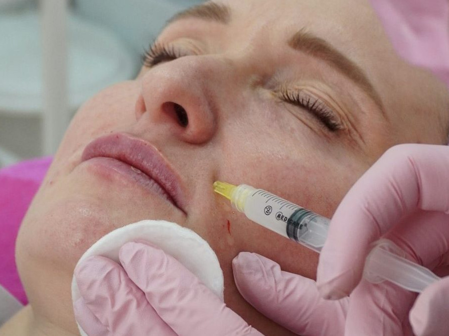 Kozmetický salón, botox